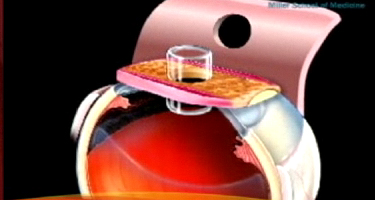 TOOTH IN EYE SURGERY - Weekly World News